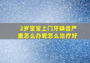 2岁宝宝上门牙龋齿严重怎么办呢怎么治疗好