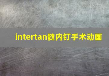 intertan髓内钉手术动画