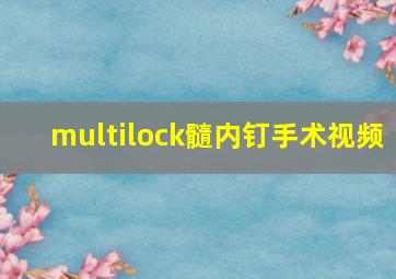 multilock髓内钉手术视频