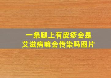 一条腿上有皮疹会是艾滋病嘛会传染吗图片