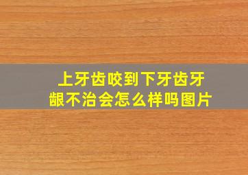 上牙齿咬到下牙齿牙龈不治会怎么样吗图片