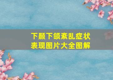 下颞下颌紊乱症状表现图片大全图解