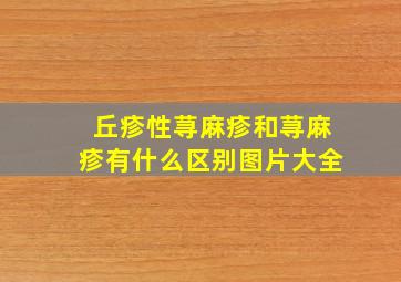 丘疹性荨麻疹和荨麻疹有什么区别图片大全