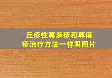 丘疹性荨麻疹和荨麻疹治疗方法一样吗图片