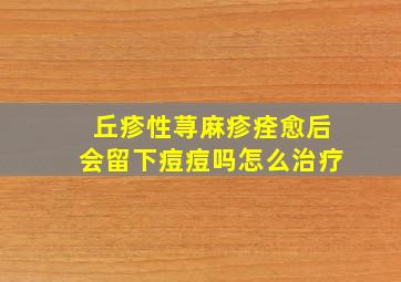 丘疹性荨麻疹痊愈后会留下痘痘吗怎么治疗