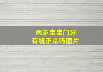 两岁宝宝门牙有缝正常吗图片