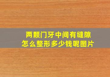 两颗门牙中间有缝隙怎么整形多少钱呢图片