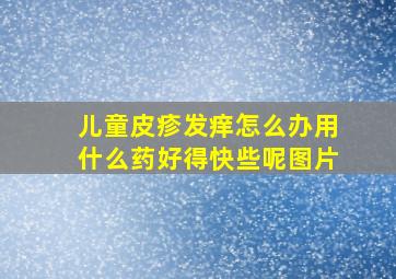 儿童皮疹发痒怎么办用什么药好得快些呢图片