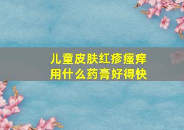 儿童皮肤红疹瘙痒用什么药膏好得快