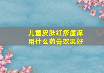 儿童皮肤红疹瘙痒用什么药膏效果好