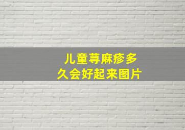 儿童荨麻疹多久会好起来图片