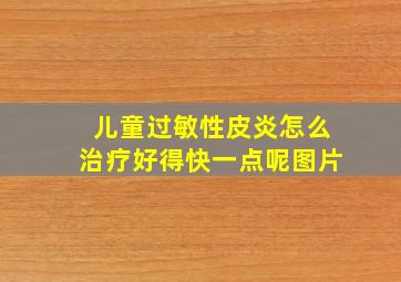 儿童过敏性皮炎怎么治疗好得快一点呢图片