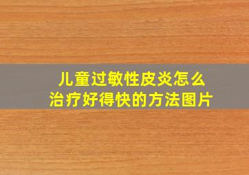 儿童过敏性皮炎怎么治疗好得快的方法图片