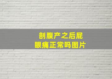 剖腹产之后屁眼痛正常吗图片