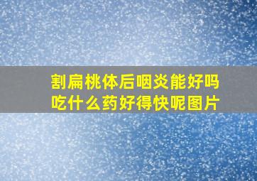 割扁桃体后咽炎能好吗吃什么药好得快呢图片