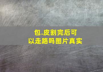 包.皮割完后可以走路吗图片真实