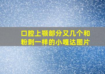 口腔上颚部分又几个和粉刺一样的小嘎达图片