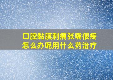 口腔黏膜刺痛张嘴很疼怎么办呢用什么药治疗