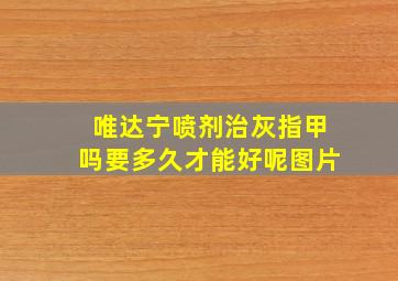 唯达宁喷剂治灰指甲吗要多久才能好呢图片