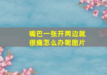 嘴巴一张开两边就很痛怎么办呢图片