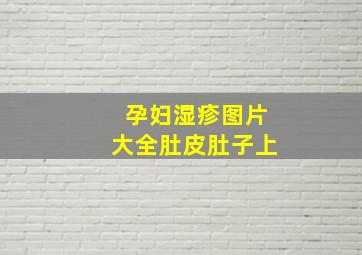 孕妇湿疹图片大全肚皮肚子上