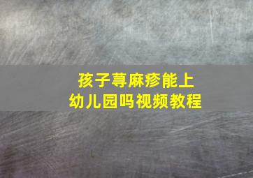 孩子荨麻疹能上幼儿园吗视频教程