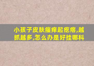 小孩子皮肤瘙痒起疙瘩,越抓越多,怎么办是好挂哪科