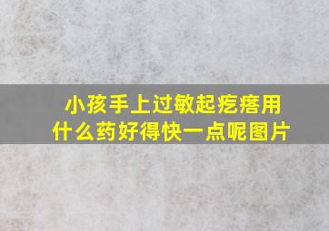 小孩手上过敏起疙瘩用什么药好得快一点呢图片