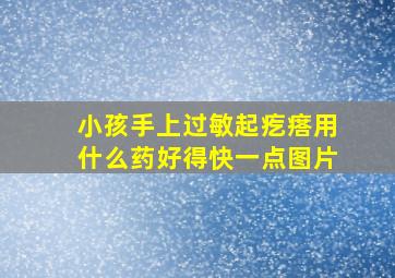 小孩手上过敏起疙瘩用什么药好得快一点图片