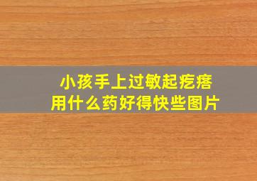 小孩手上过敏起疙瘩用什么药好得快些图片