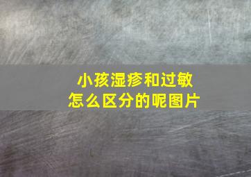 小孩湿疹和过敏怎么区分的呢图片