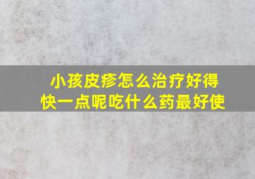 小孩皮疹怎么治疗好得快一点呢吃什么药最好使