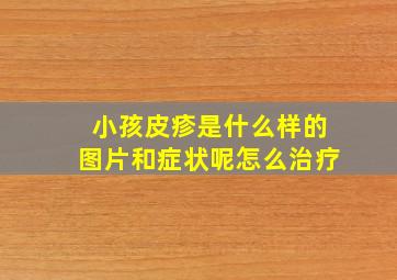 小孩皮疹是什么样的图片和症状呢怎么治疗