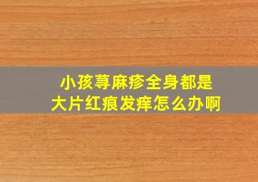 小孩荨麻疹全身都是大片红痕发痒怎么办啊