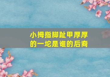 小拇指脚趾甲厚厚的一坨是谁的后裔