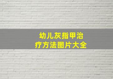 幼儿灰指甲治疗方法图片大全