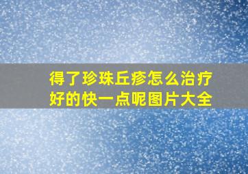 得了珍珠丘疹怎么治疗好的快一点呢图片大全