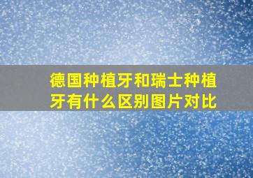 德国种植牙和瑞士种植牙有什么区别图片对比