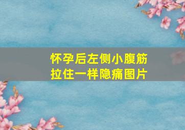 怀孕后左侧小腹筋拉住一样隐痛图片