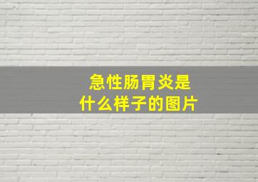 急性肠胃炎是什么样子的图片