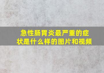 急性肠胃炎最严重的症状是什么样的图片和视频