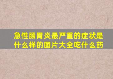 急性肠胃炎最严重的症状是什么样的图片大全吃什么药