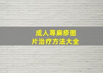 成人荨麻疹图片治疗方法大全