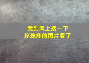 我到网上搜一下珍珠疹的图片看了