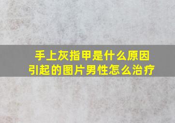 手上灰指甲是什么原因引起的图片男性怎么治疗