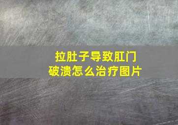 拉肚子导致肛门破溃怎么治疗图片