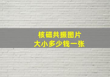 核磁共振图片大小多少钱一张