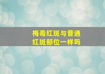 梅毒红斑与普通红斑部位一样吗