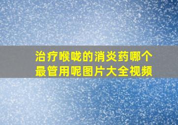 治疗喉咙的消炎药哪个最管用呢图片大全视频