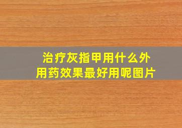 治疗灰指甲用什么外用药效果最好用呢图片